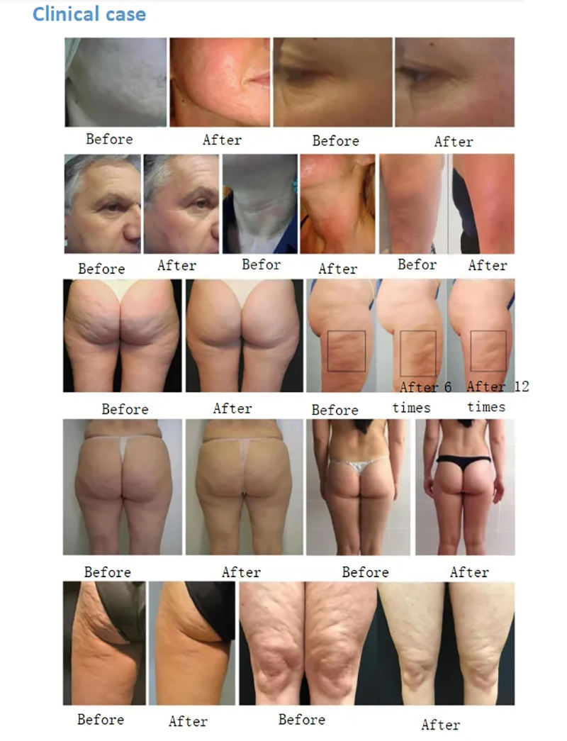 professional body shaping