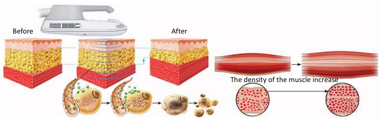 Fat Reduction