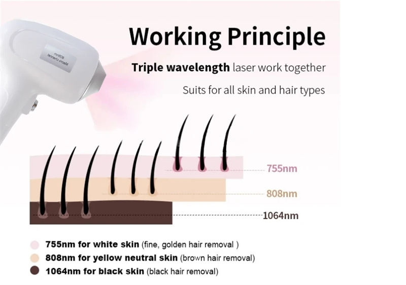808nm laser hair removal device