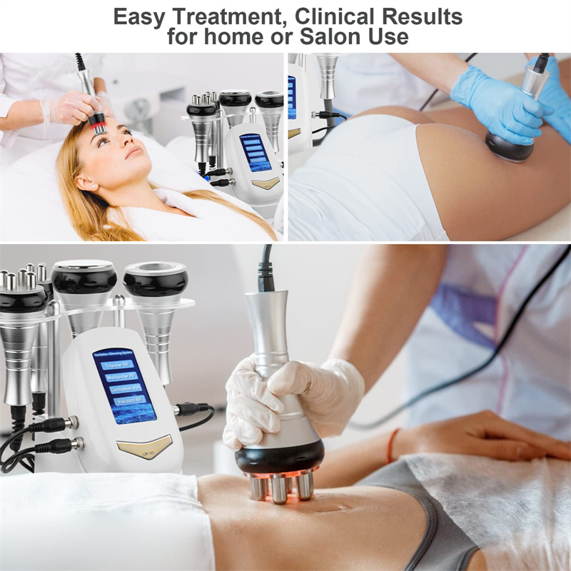 ultrasonic cavitation