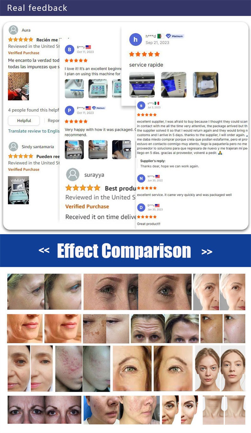 14-in-1 hydrodermabrasion facial