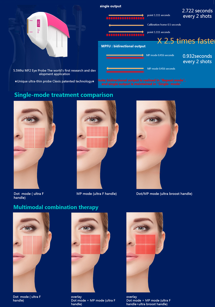 ultraformer face lift