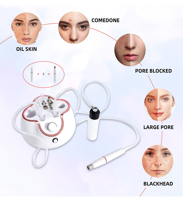 3 in 1 microdermabrasion machine