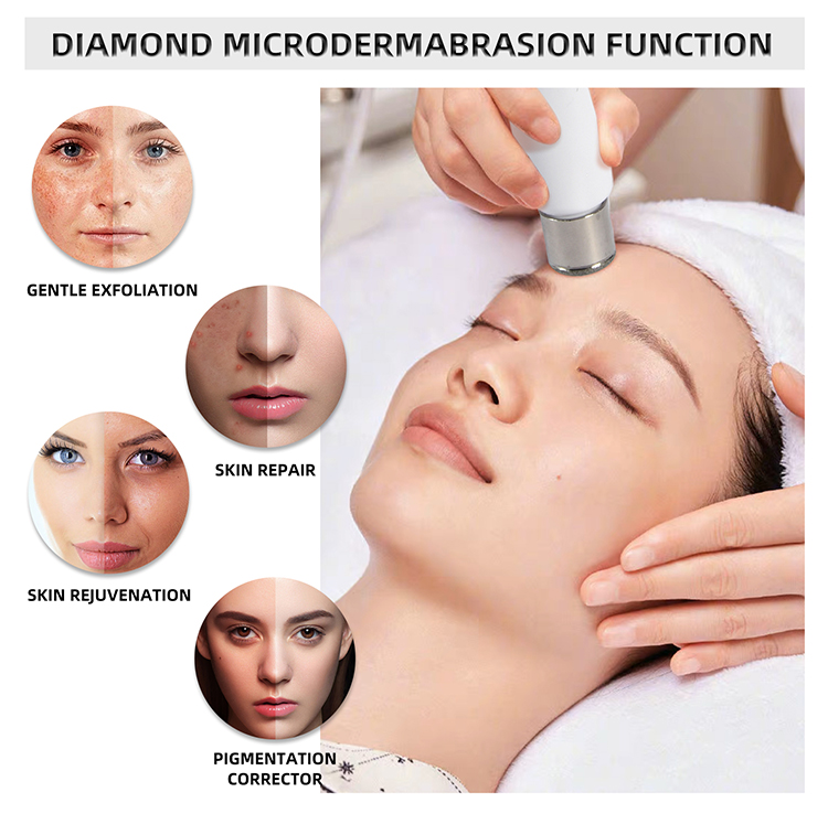 diamond skin microdermabrasion machine