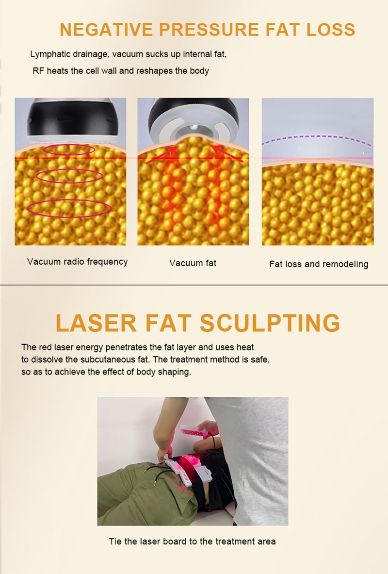 Ultrasonic Fat Cavitation