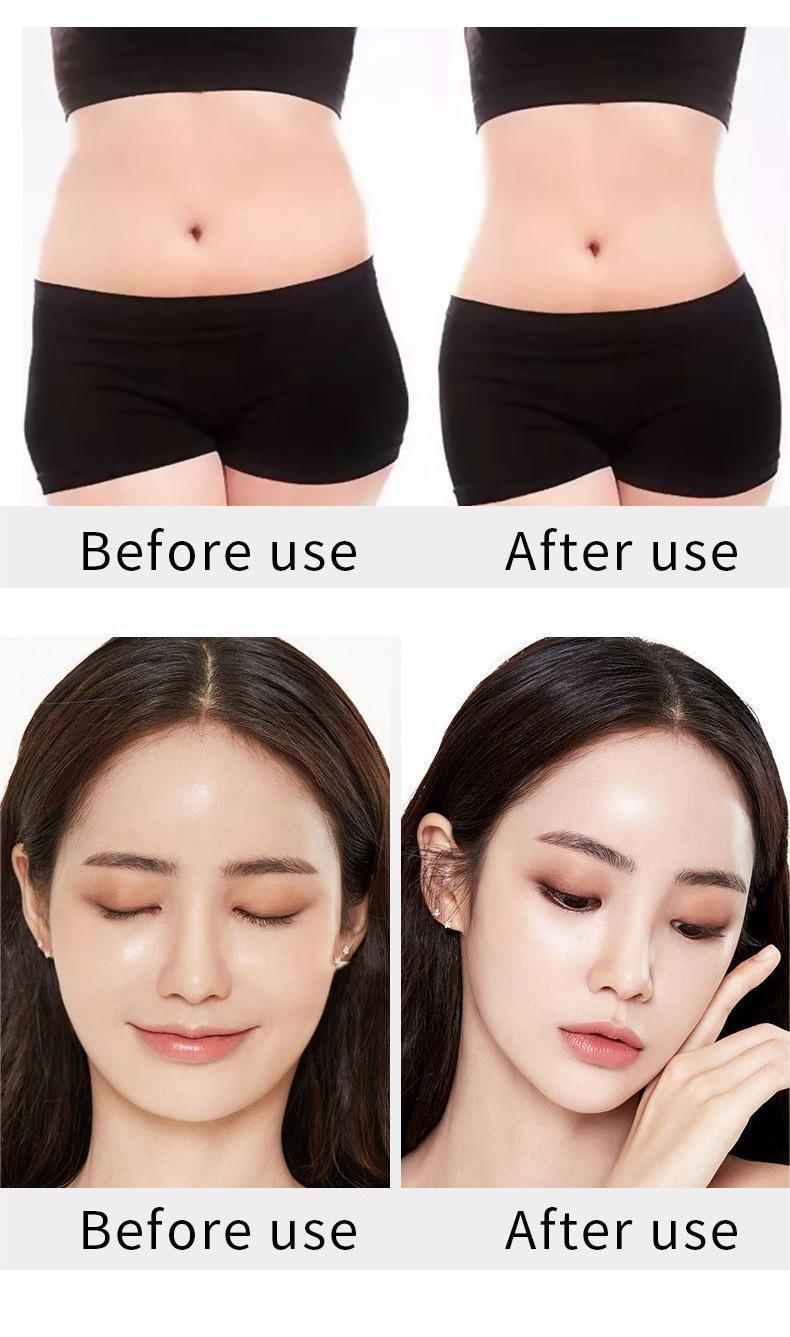 Fat Cavitation Machine