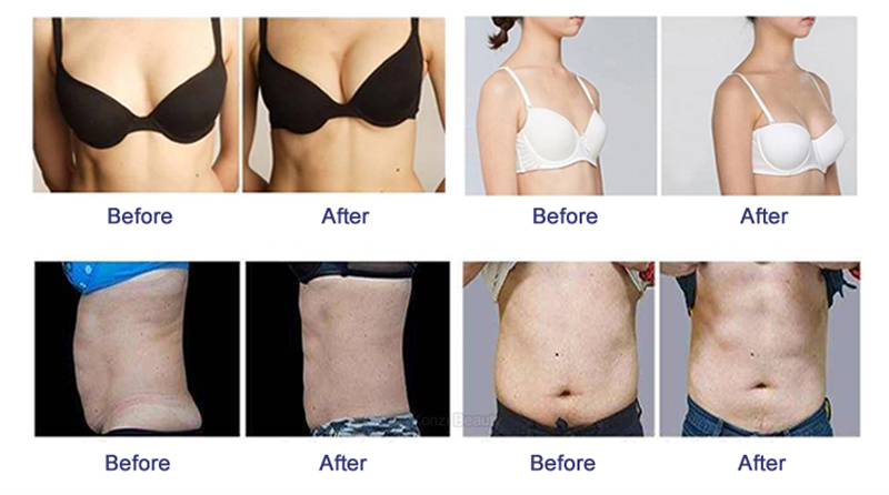 EMS Electric Muscle Stimulator EMS Electric Muscle Stimulator