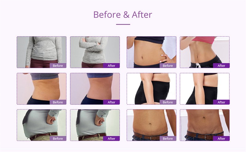 fat cavitation machine fat cavitation machine