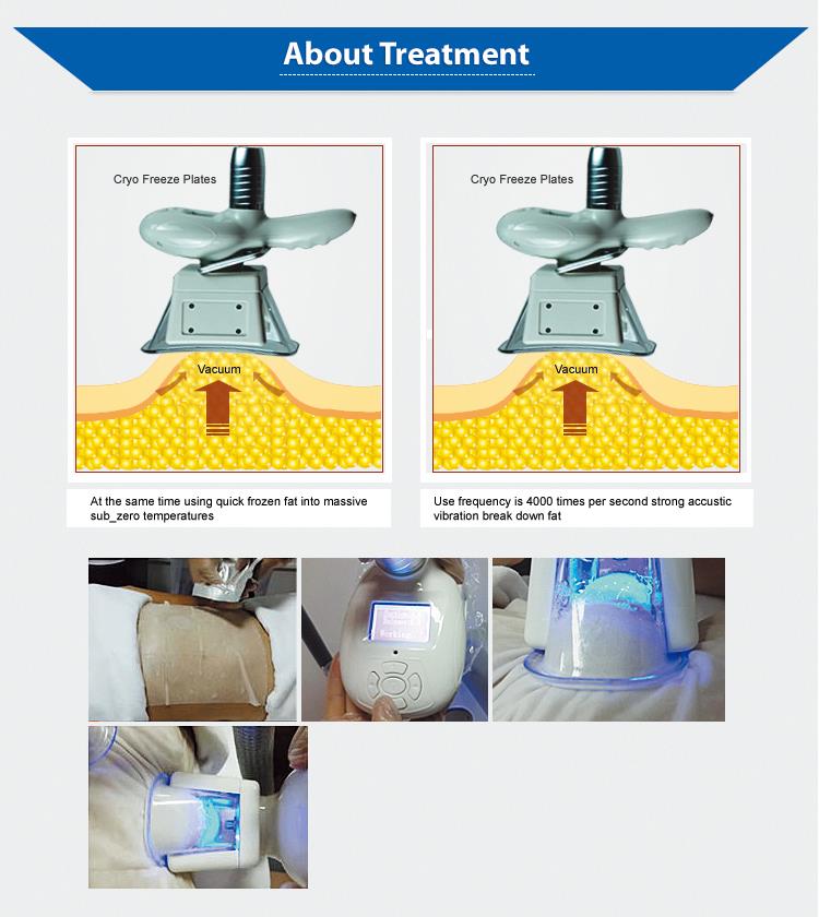 cool body sculpting machine