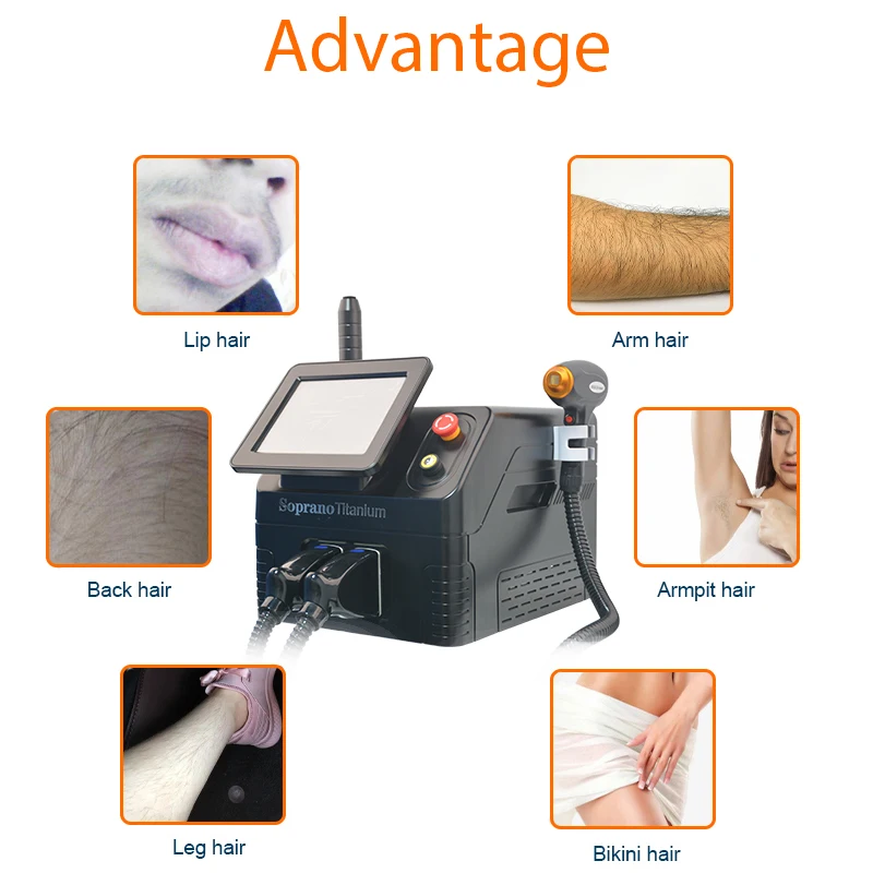 laser hair removal machine