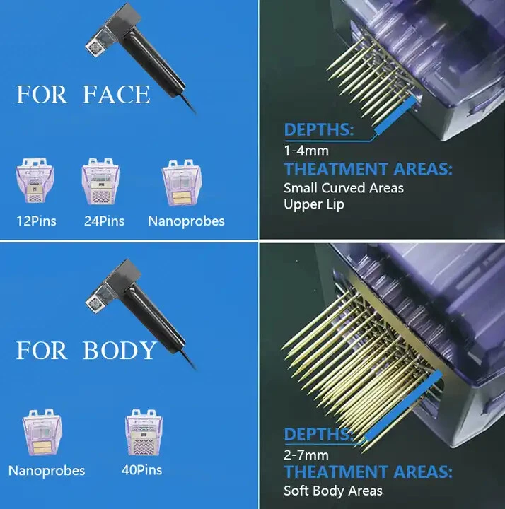 microneedling with radiofrequency