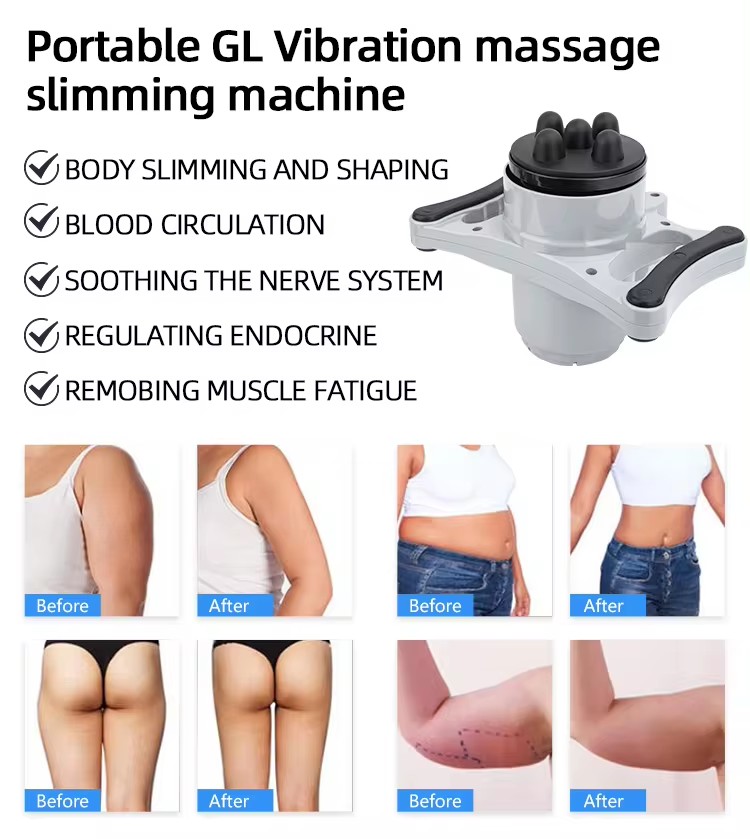 electric body roller machine electric body roller machine