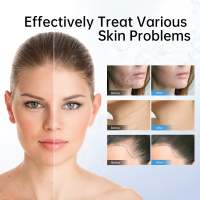 Dr Pen Ultima Dermapen 12 Needle Microneedling Skin