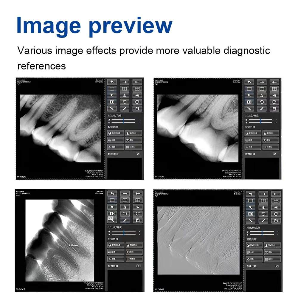 dental X-ray portable digital sensor