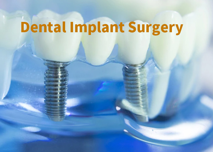 Is Dental Implant Surgery Right for You?