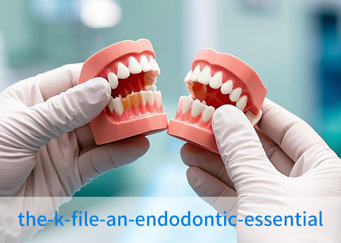 The K-File: An Endodontic Essential The K-File: An Endodontic Essential