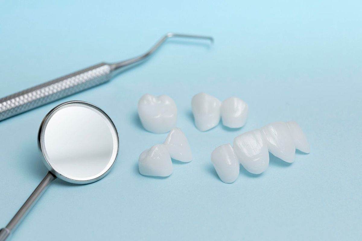 rotary files dental rotary files dental