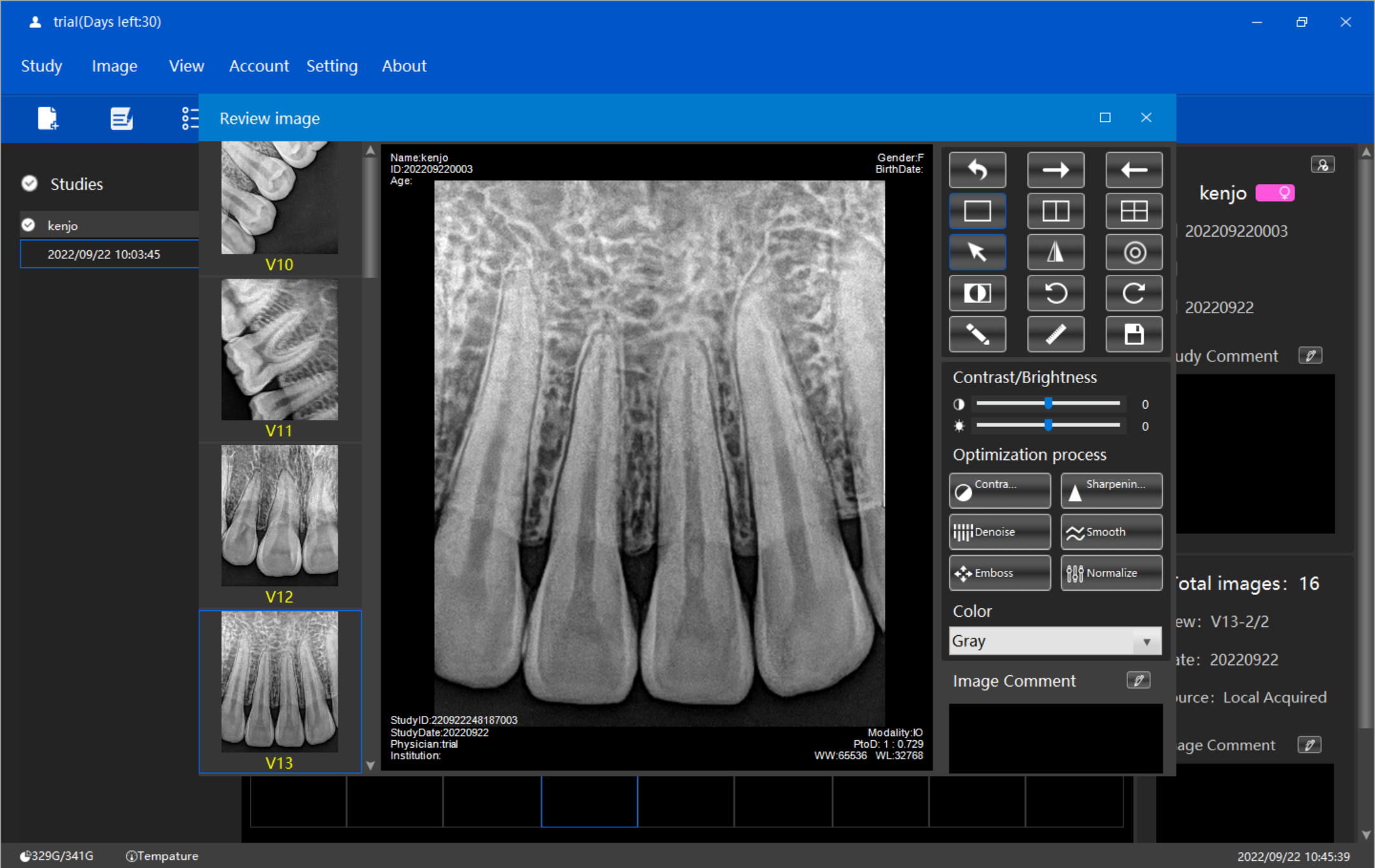 xray sensor