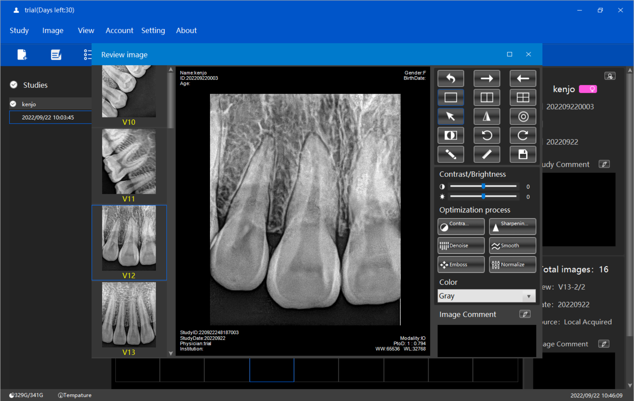 dental xray sensor