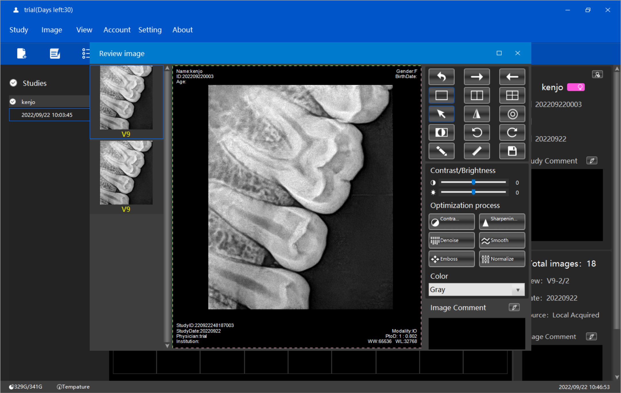 digital dental xray sensor