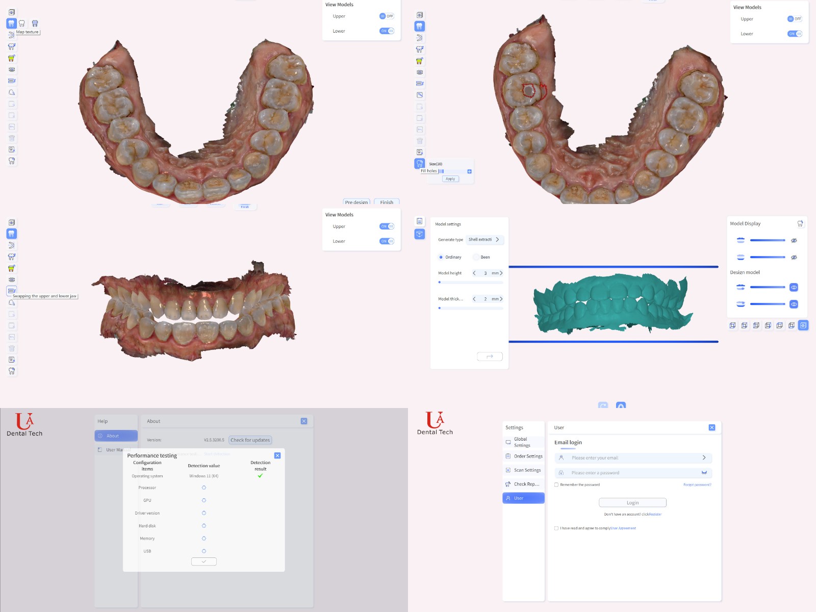 dental intraoral scanner