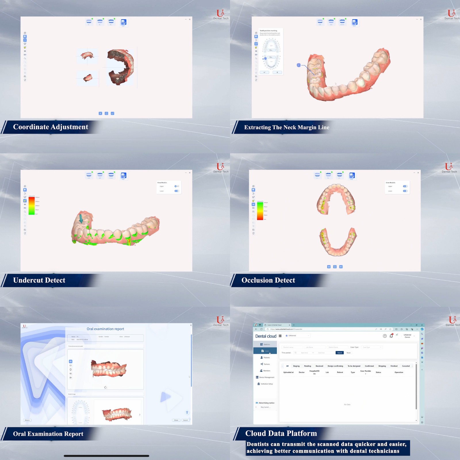 3d dental scanner