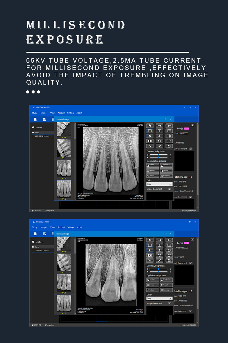 dental xray gun