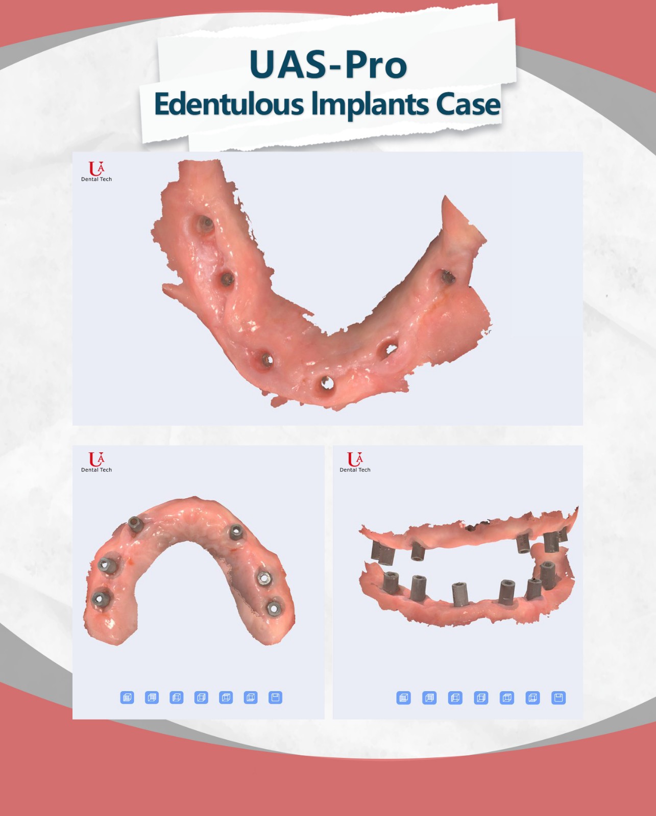 3d dental scanner