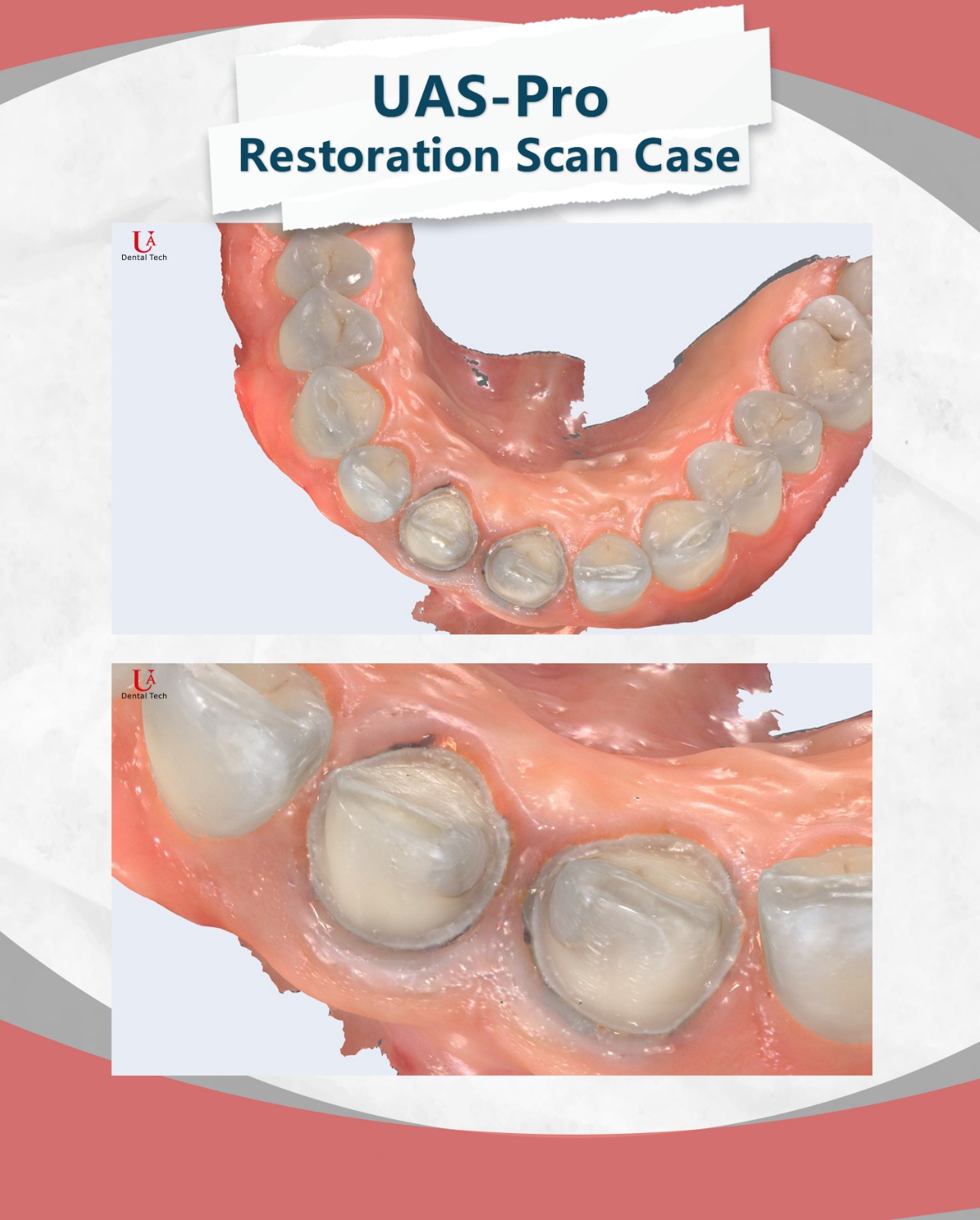 dental scanner