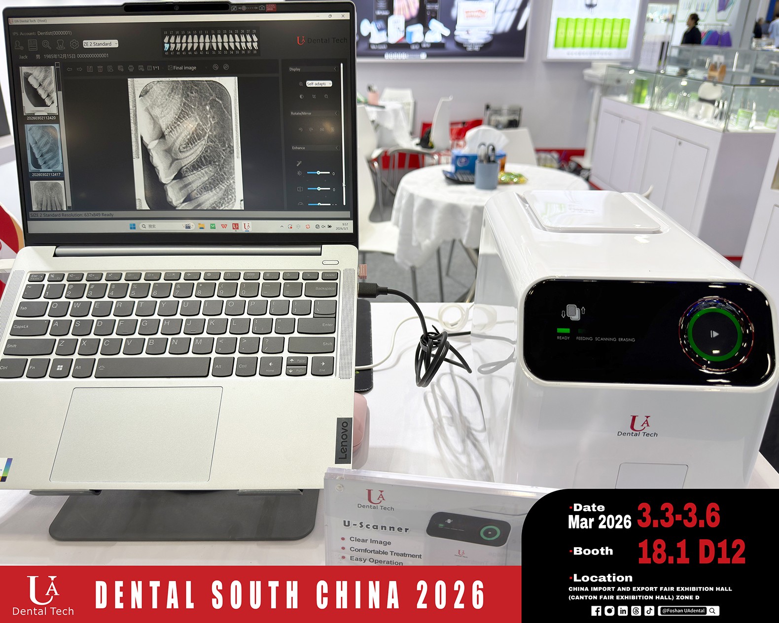 DENTAL SOUTH CHINA 2026