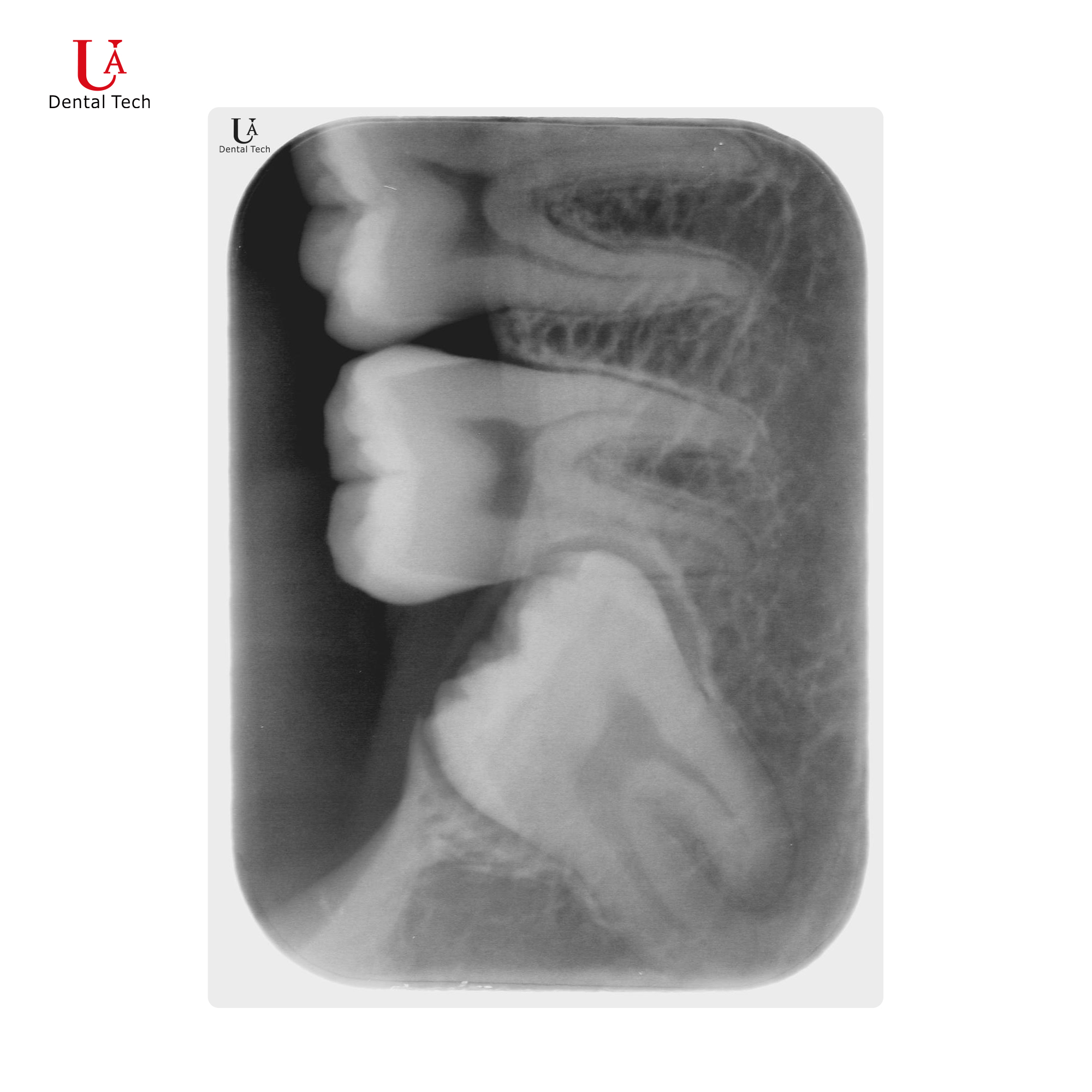 U-Scanner Image Acquisition System