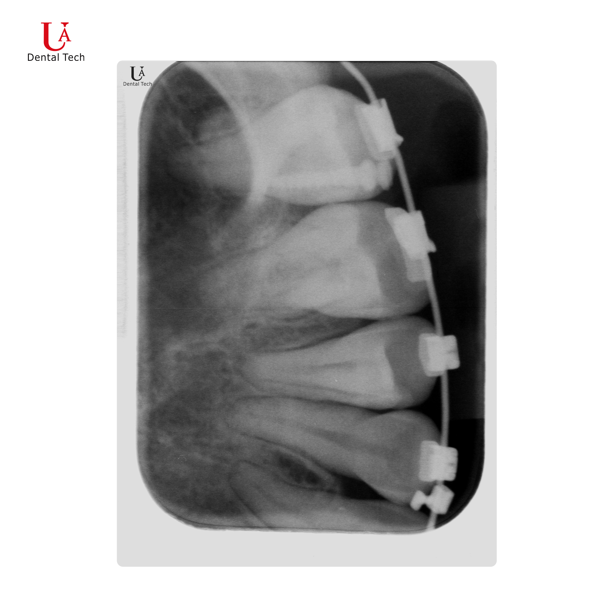 U-Scanner Image Acquisition System