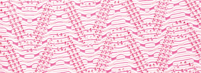 computerized jacquard knitting machine