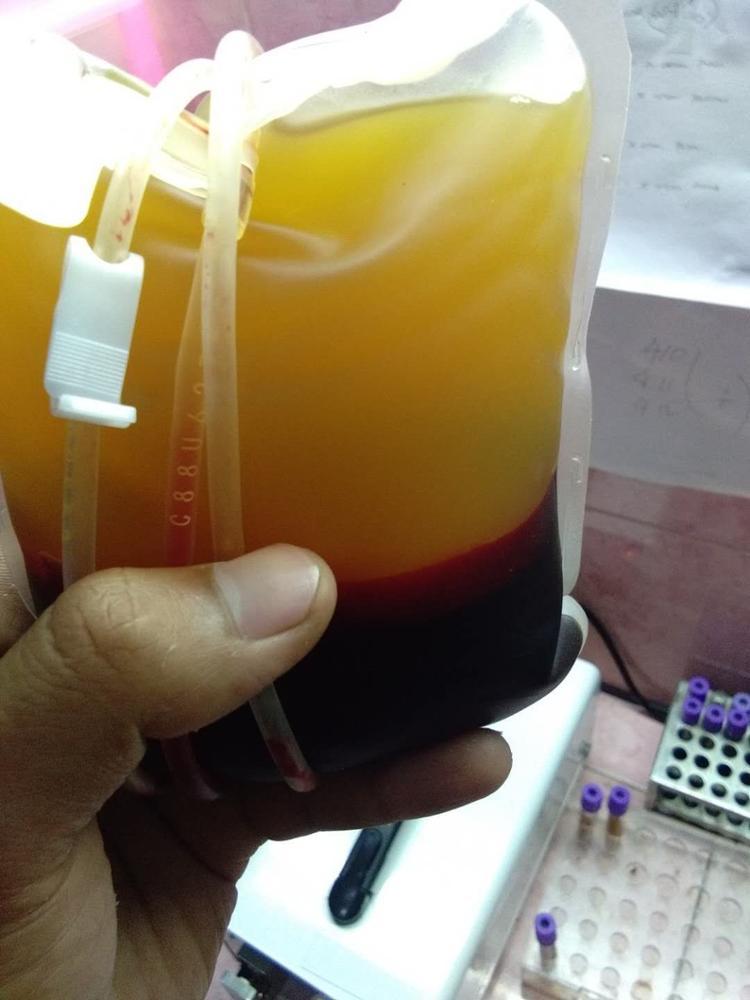 Максимальная емкость 6000 мл Центрифуга крови банка крови 6000 об/мин