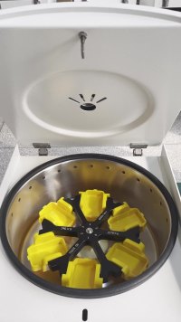 Medical Cytological Liquid Based Cytology Cell Smear Cyto Centrifuge Machine Cytoprep-1