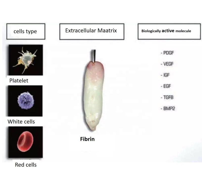 Benchtop TD4A-WS Low speed PRF CGF PRP centrifuge 4000rpm