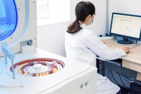 Self diagnosis for centrifuge fault