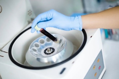 What is Balanced Centrifuges and why is balancing a centrifuge Important