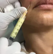 Shangyi: Natural PE Remedies from China