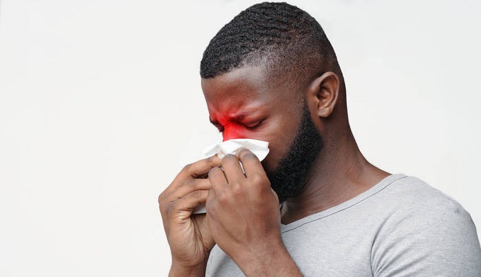 sinusitis sinus infection