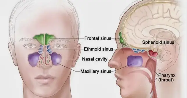 home remedies for sinus infection