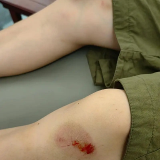 中医外伤方剂 骨伤擦剂