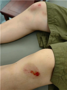 中医外伤方剂 骨伤擦剂