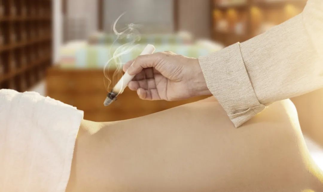 moxibustion