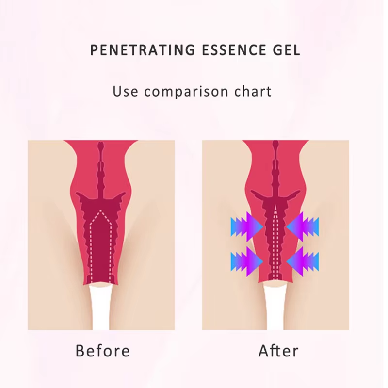 Vaginal Tightening Gel