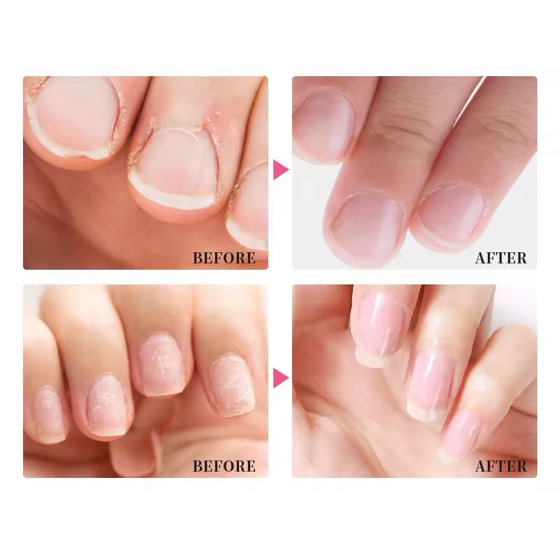 Remove Barbed Nail Polish