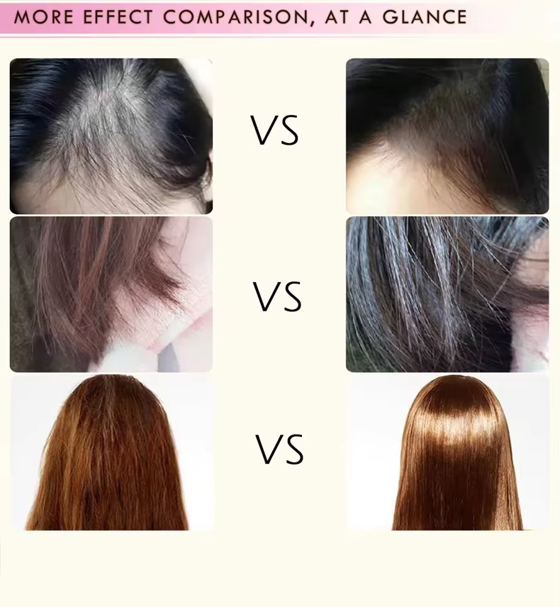 Hair Growth Serum OEM