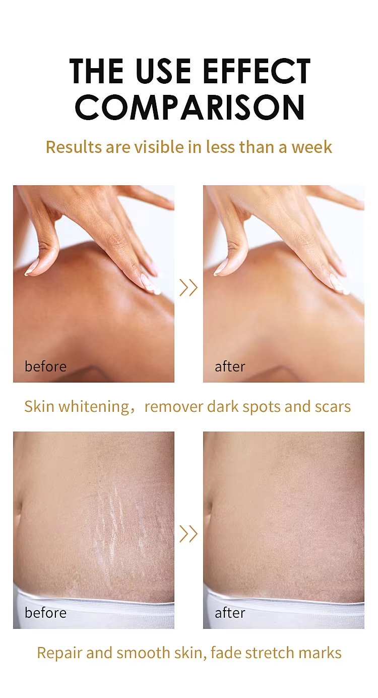 Removing dead skin and exfoliating oil