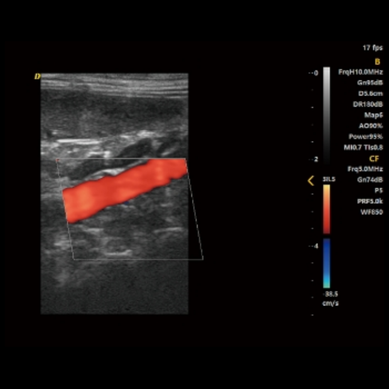 Laptop Pet Ultrasound Machine
