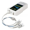 Veterinary ETCO2 Monitor